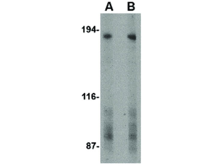 Western Blot of TEM5 Antibody