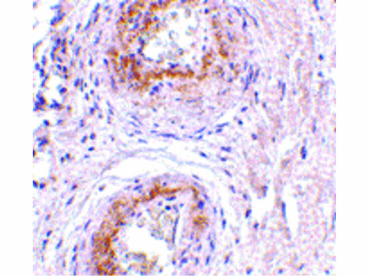 Immunohistochemistry of TEM5 Antibody