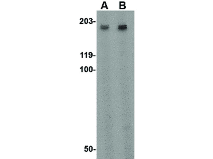 Western Blot of TEM5 Antibody