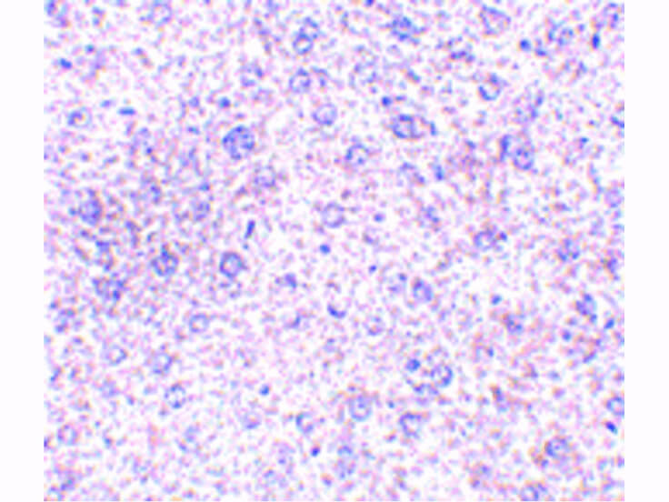 Immunohistochemistry of TEM7 Antibody