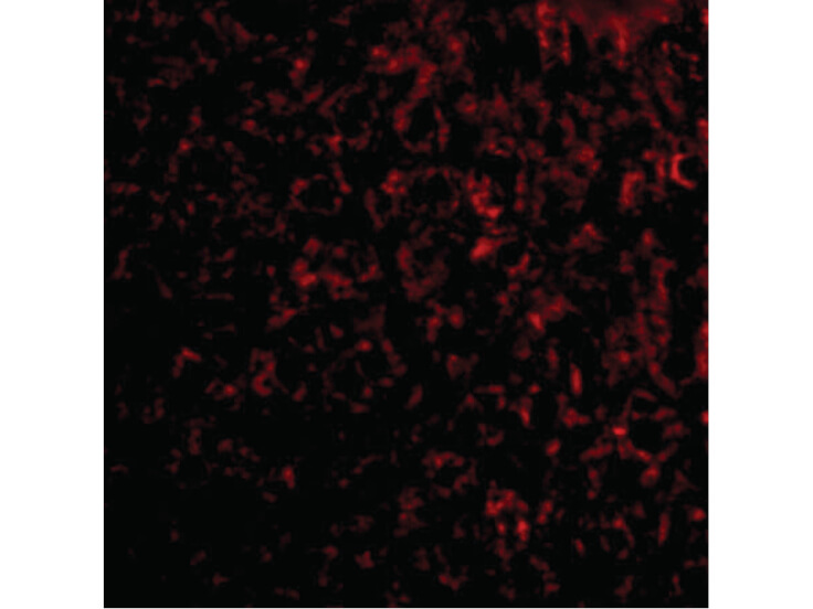 Immunofluorescence of TEM7 Antibody