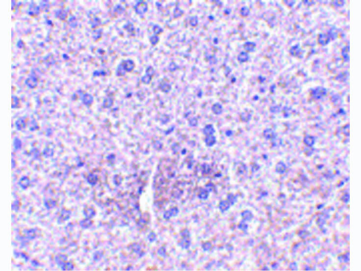 Immunohistochemistry of TEM7 Antibody