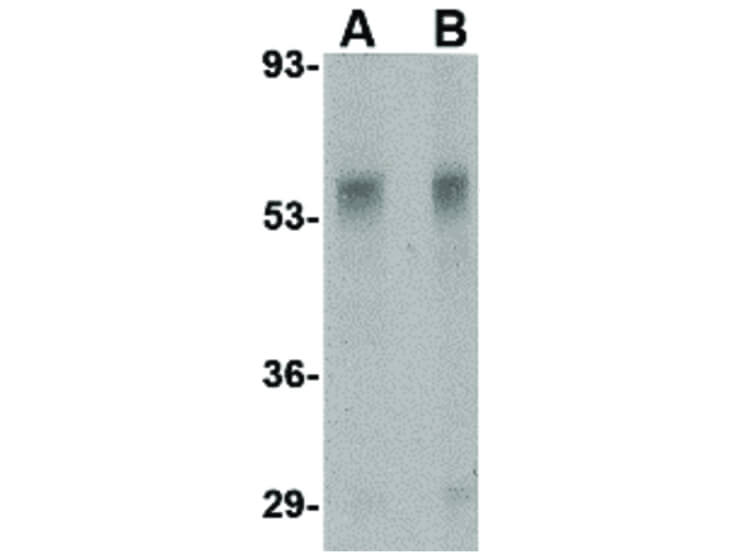 Western Blot of TEM7 Antibody