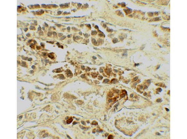 Immunohistochemistry of TERF2