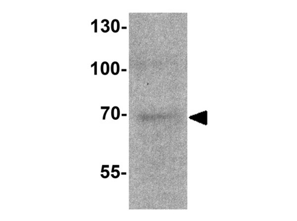 Western blot of TERF2