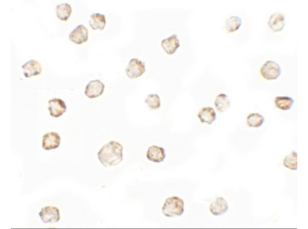 Immunocytochemistry of TESPA1