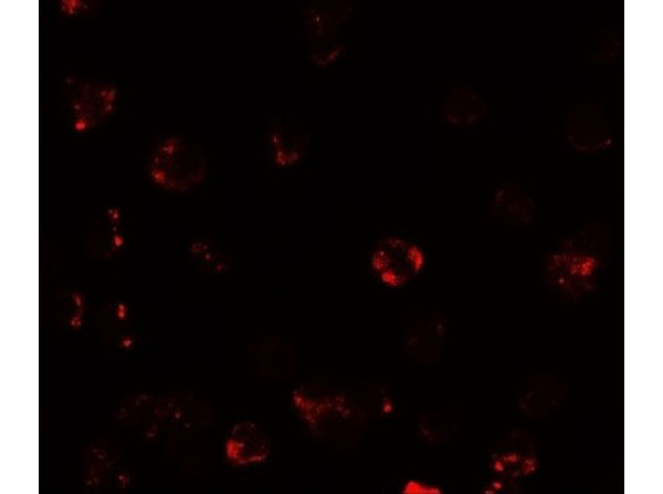 Immunofluorescence of TESPA1