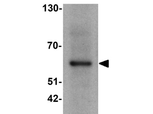 Western blot of TESPA1