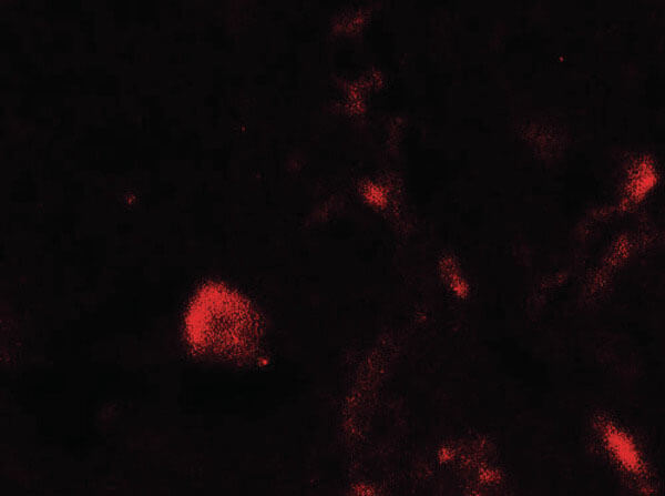 Immunofluorescence of TET1 Antibody