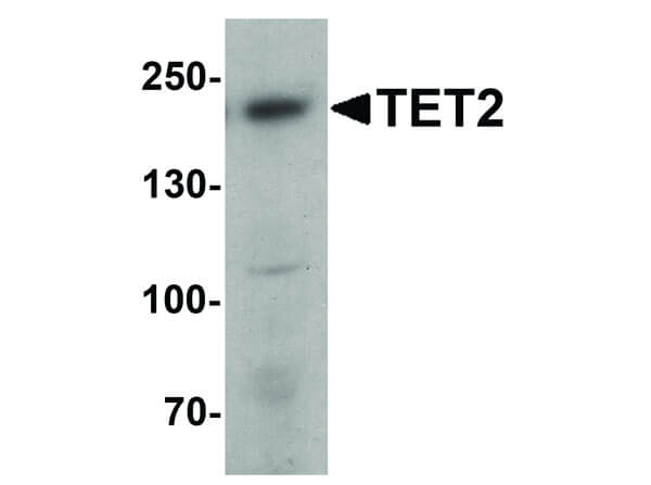 Western Blot of TET2 Antibody