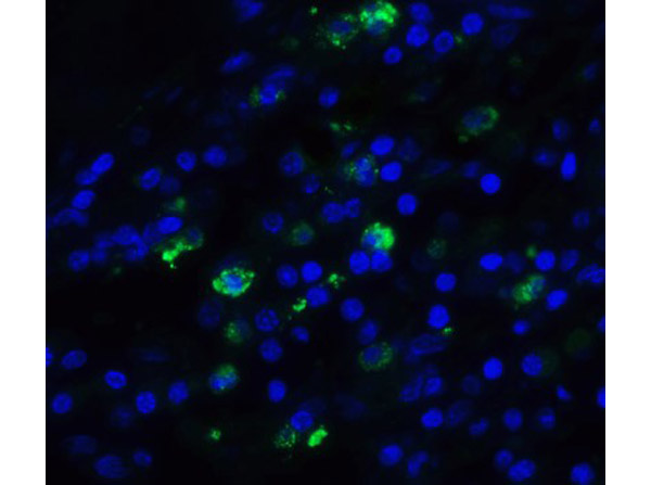 Immunofluorescence of TFF3