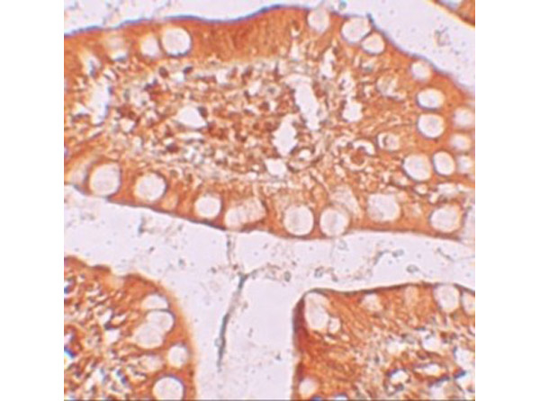 Immunohistochemistry of TFF3