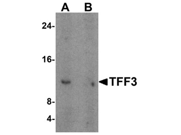 Western blot analysis of TFF3