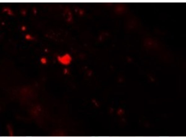 Immunofluorescence of TFF3