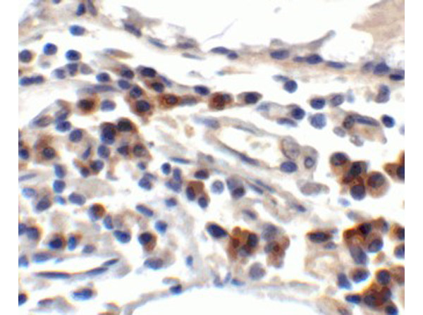 Immunohistochemistry of TFF3