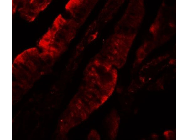 Immunofluorescence of TFPI