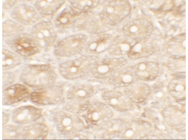 Immunohistochemistry of TFPI