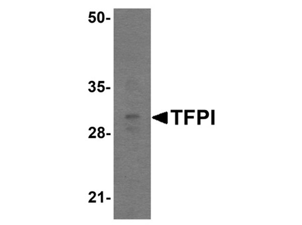 Western blot of TFPI