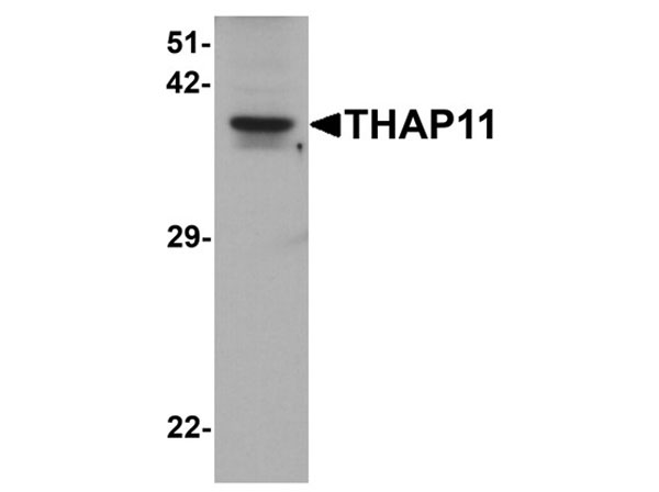 Western blot of THAP11