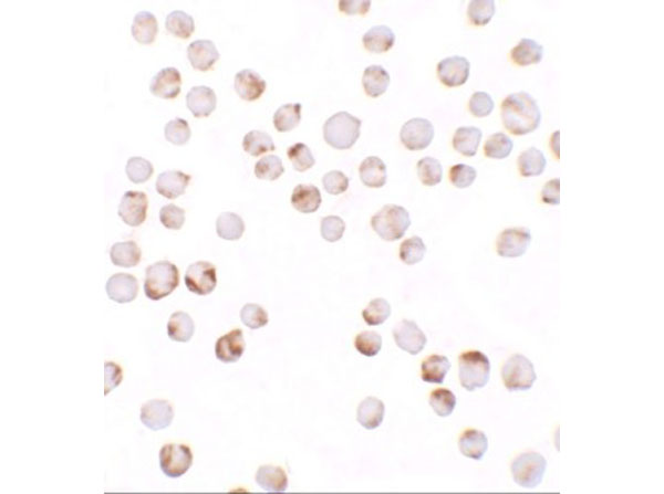 Immunocytochemistry of TIAF
