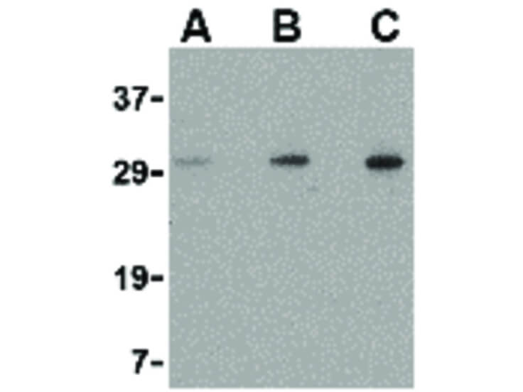 Western Blot of TIGAR Antibody