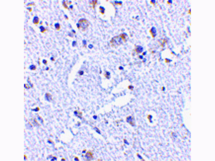 Immunohistochemistry of TIGAR Antibody