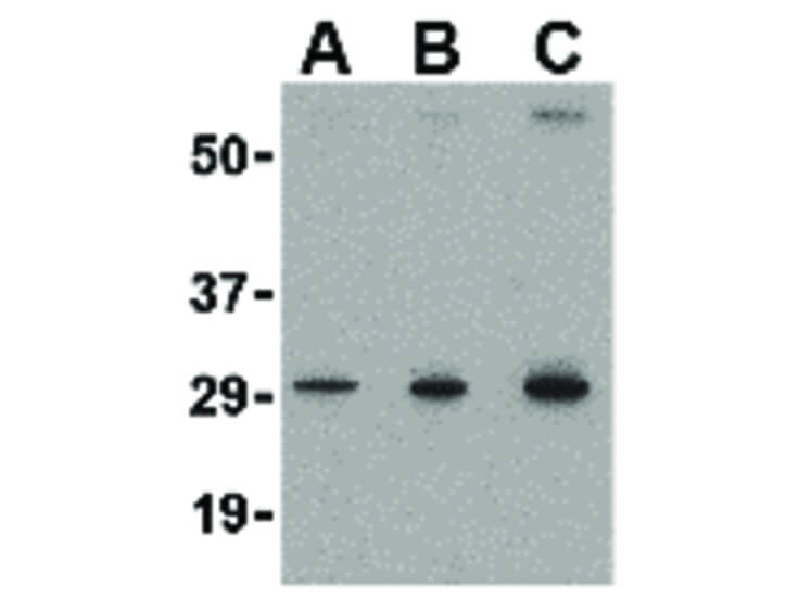 Western Blot of TIGAR Antibody