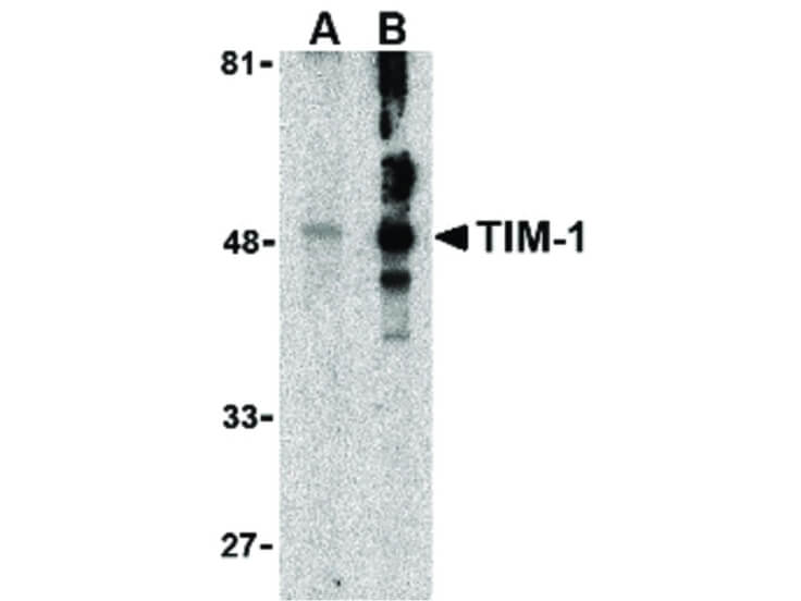 Western Blot of TIM-1 Antibody