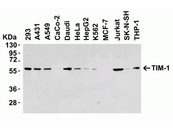 Western Blot of TIM-1