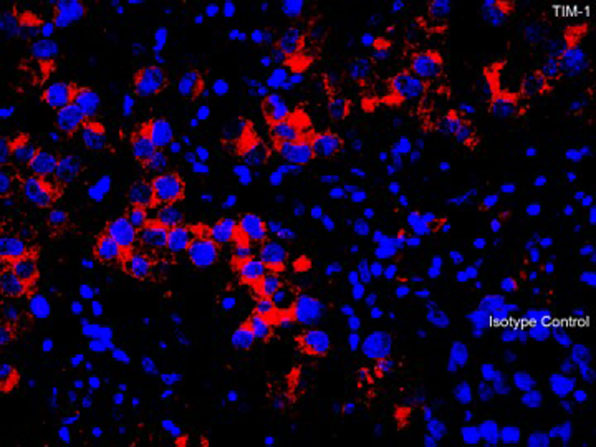 Immunofluorescence of TIM-1