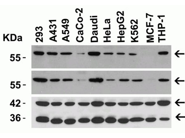 Western Blot of TIM-1