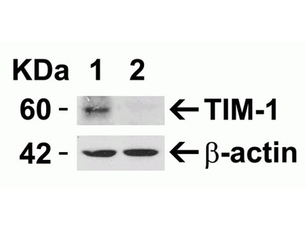 Western Blot of TIM-1