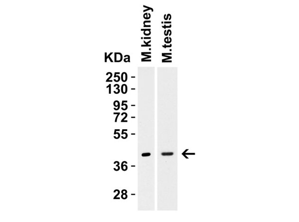 Western Blot of TIM-1