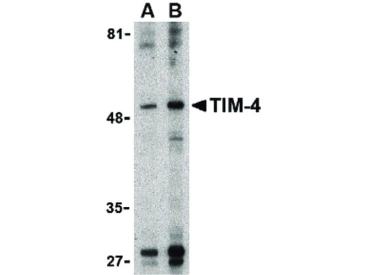 Western Blot of TIM-4 Antibody