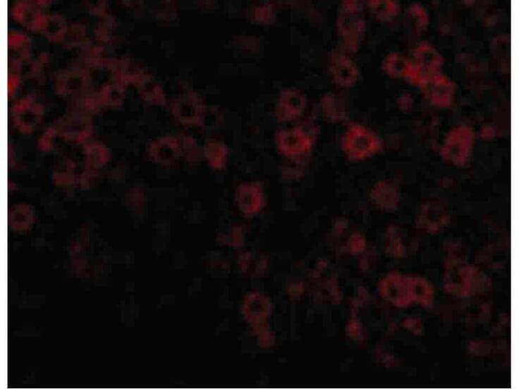 Immunofluorescence of TIP47 Antibody