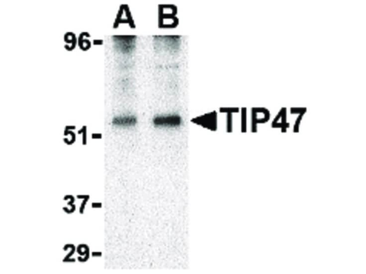 Western Blot of TIP47 Antibody
