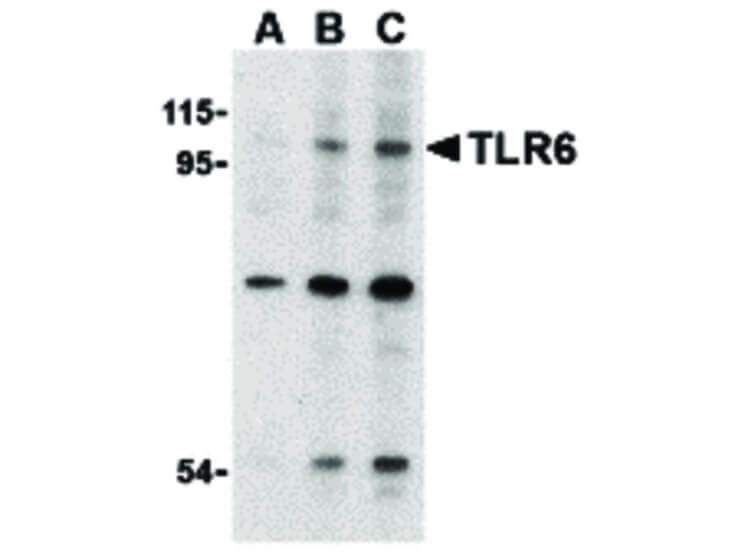 Western Blot of TLR6 Antibody