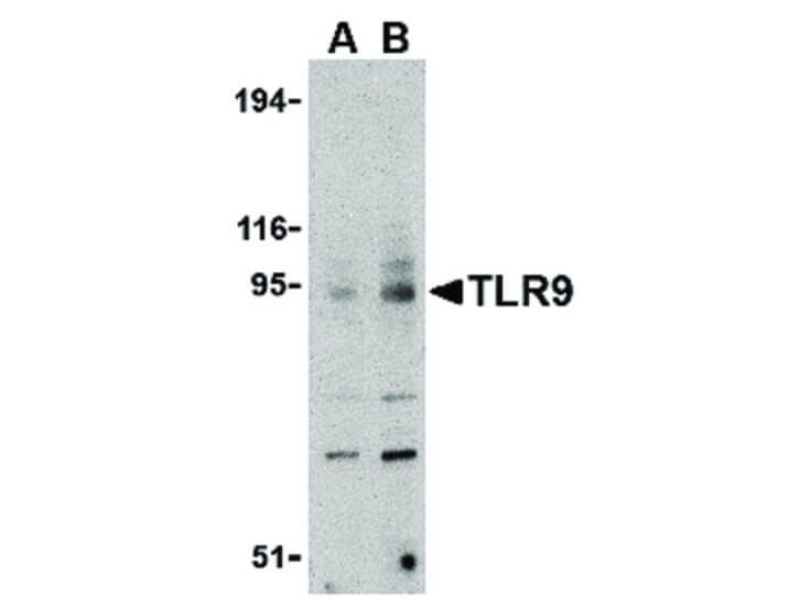 Western Blot of TLR9 Antibody