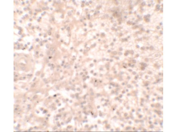 Immunohistochemistry of TLX1
