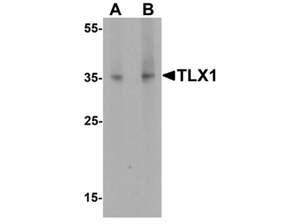 Western blot of TLX1