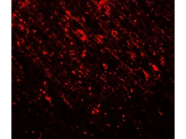 Immunofluorescence of TLX2