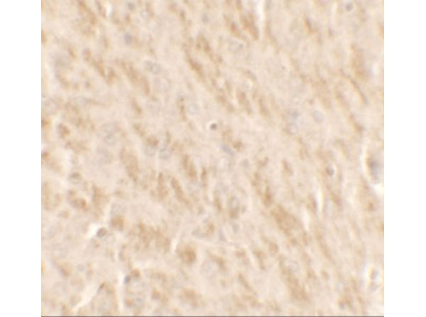 Immunohistochemistry of TLX2