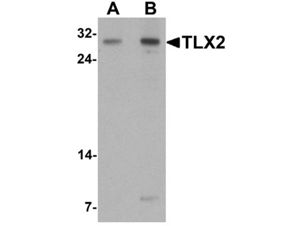 Western blot of TLX2