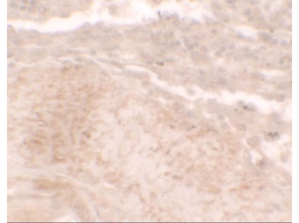 Immunohistochemistry of TLX3
