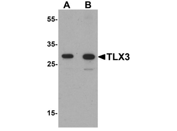Western blot of TLX3