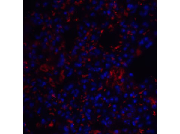 Immunofluorescence of TM4SF1