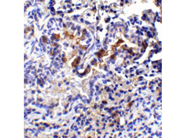 Immunohistochemistry of TM4SF1