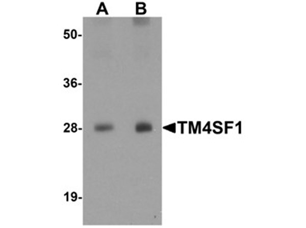 Western blot analysis of TM4SF1