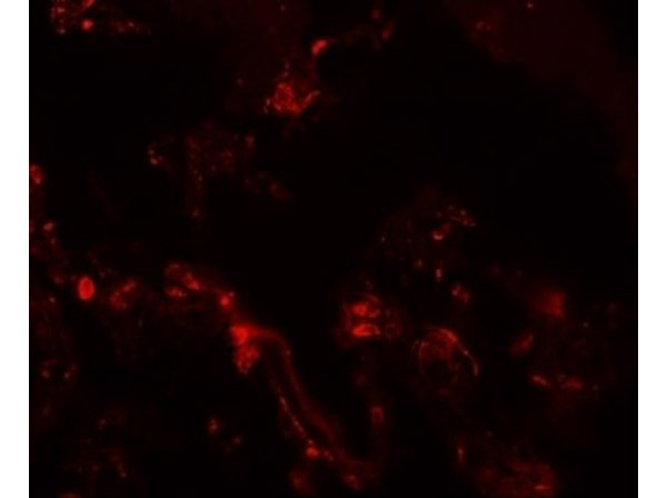 Immunofluorescence of TM4SF1