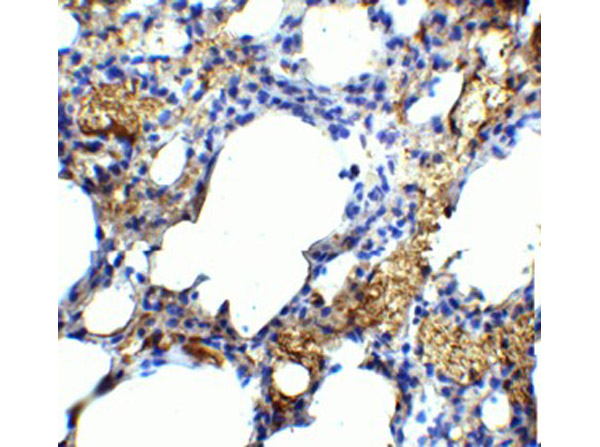 Immunohistochemistry of TM4SF1